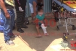 ARIQUEMES: Passageira quebra a perna após moto derrapar em areia no Jorge Teixeira
