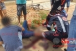 ARIQUEMES: Jovem fica com perna dilacerada após chocar–se contra mureta no Bairro Zona Sul