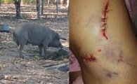 Moradora de RO quase perde a perna ao ser atacada por porco doméstico