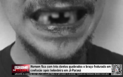 Homem fica com tr&ecirc;s dentes quebras e bra&ccedil;o fraturado em confus&atilde;o ap&oacute;s bebedeira em Ji&ndash;Paran&aacute; &ndash; V&iacute;deo