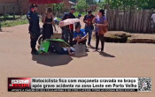 Motociclista fica com ma&ccedil;aneta cravada no bra&ccedil;o ap&oacute;s grave acidente na zona Leste em Porto Velho &ndash; V&iacute;deo