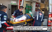 Motociclista sofre fratura exposta na perna e quebra o bra&ccedil;o em acidente na BR&ndash;364 em Rio Crespo &ndash; V&iacute;deo