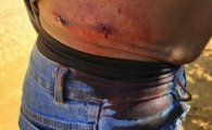 Motorista escapa de tentativa de homic&iacute;dio durante frete na zona rural