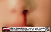 Mulher &eacute; agredida com chute no rosto durante discuss&atilde;o com companheiro em Ji&ndash;Paran&aacute; &ndash; V&iacute;deo
