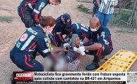 Motociclista fica gravemente ferido com fratura exposta ap&oacute;s colis&atilde;o com caminh&atilde;o na BR&ndash;421 Ariquemes &ndash; V&Iacute;DEO