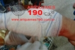 ARIQUEMES: Trabalhadora prende a m&atilde;o em m&aacute;quina de amaciar carne e &eacute; socorrida pelo Corpo de Bombeiros