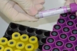 Coleta de Exames laboratoriais passa a ser feita no Hospital da Criança em Ariquemes