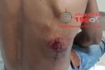ALTO PARAÍSO: Rapaz é baleado nas costas em tentativa de roubo