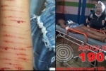 Menina de 13 anos realiza cortes no braço com lâminas – Família suspeita que adolescente jogava Baleia Azul