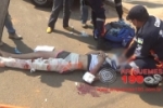 ARIQUEMES: Grave acidente no Setor 06 deixa jovem motociclista com fratura no fêmur