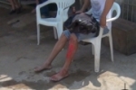 ARIQUEMES: Jovem sofre escoriações após colidir com meio fio na Av. JK