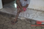 ARIQUEMES: Rapaz de 18 anos é atingido com tiro no pé na Praça do Lago