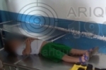 ARIQUEMES: Criança sofre traumatismo craniano em acidente no Setor 06