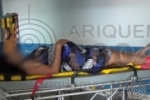 ARIQUEMES: Grávida de 8 meses sofre acidente após problema com moto