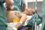 Todas as lesões têm risco de morte, diz médico que operou Jair Bolsonaro
