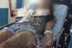 ARIQUEMES: Jovem sofre fratura no braço em acidente na Av. Perimetral Leste
