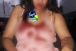 COVARDIA: Mulher &eacute; brutalmente espancada &ndash; Dente e o maxilar foram “quebrados” em Ji&ndash;Paran&aacute;