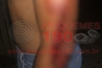 ARIQUEMES: Sitiante &eacute; alvejado a tiro por dois elementos em uma YBR na Linha 105