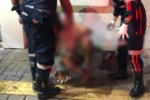 VIOL&Ecirc;NCIA SEM FIM: Morador em situa&ccedil;&atilde;o de rua &eacute; atacado a pauladas e perde muito sangue