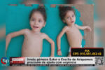 Irm&atilde;s g&ecirc;meas Ester e Cec&iacute;lia de Ariquemes precisam de ajuda com urg&ecirc;ncia &ndash; Ajude no Pix: 010.981.492&ndash;46 &ndash; V&iacute;deo