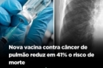 Nova vacina contra câncer de pulmão reduz em 41% o risco de morte
