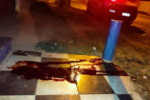 Morre no Hospital Regional de Vilhena o homem de 42 anos que havia sido resgatado por bombeiros após levar 05 tiros