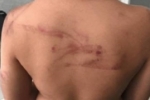 ABSURDO: Criança é agredida com facão pelo pai por perder a chave de casa