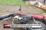 Motociclista tem bra&ccedil;o quebrado em colis&atilde;o entre moto e carro no Setor 02 &ndash; V&iacute;deo