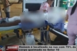 Homem &eacute; localizado na rua com 75% do corpo queimado no Setor 10 &ndash; V&iacute;deo