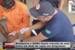 Bombeiros e SAMU fazem retirada de anel preso em dedo de rapaz em Ariquemes – Vídeo