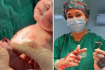 Bebê nasce em Goiás segurando DIU após gravidez inesperada da mãe