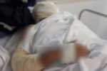 DESESPERO – Homem ateia fogo ao próprio corpo e é intubado em estado grave em Rondônia