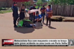 Motociclista fica com ma&ccedil;aneta cravada no bra&ccedil;o ap&oacute;s grave acidente na zona Leste em Porto Velho &ndash; V&iacute;deo