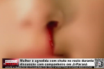 Mulher &eacute; agredida com chute no rosto durante discuss&atilde;o com companheiro em Ji&ndash;Paran&aacute; &ndash; V&iacute;deo