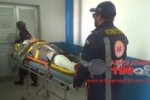 ARIQUEMES: Motociclista sofre fratura exposta após cair de moto na BR–364